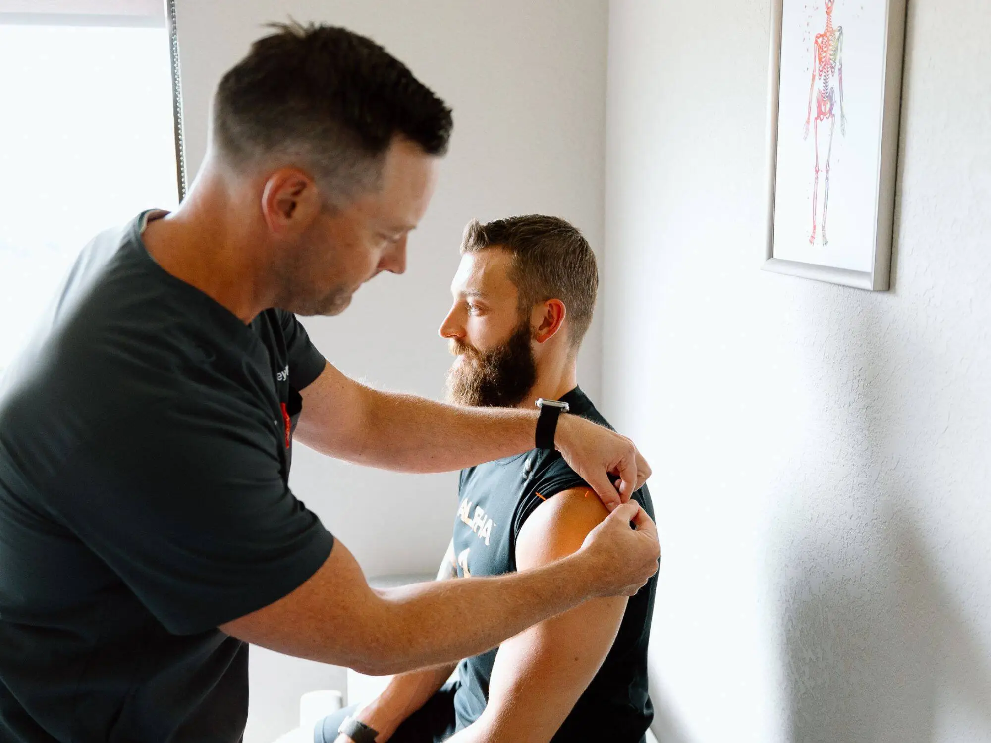 Discover Acupuncture Benefits in Kansas City with Meylor Chiropractic