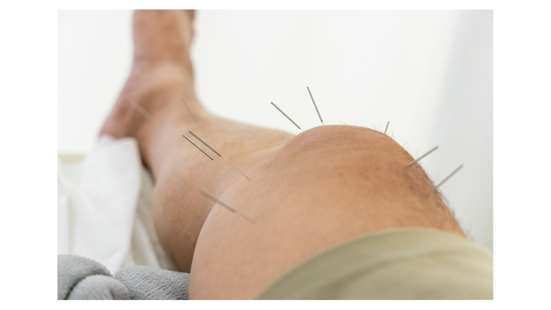 How to Find a Qualified Acupuncturist in Lenexa: What to Look For